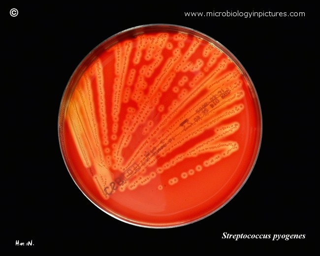 Streptococcus pyogenes colonies on blood agar